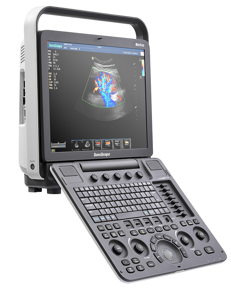 Ультразвуковой сканер S8Exp «Доступный премиум-класс»